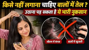 Who Should NOT Apply Hair Oil? Hidden Side Effects You Must Know