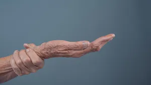 World Parkinsons Day 2026 How To Tell If A Tremor Is Parkinsons Or Something Else